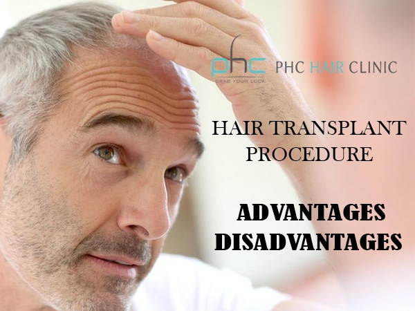 Hair Transplant Procedure | Advantages Disadvantages of Hair Transplant