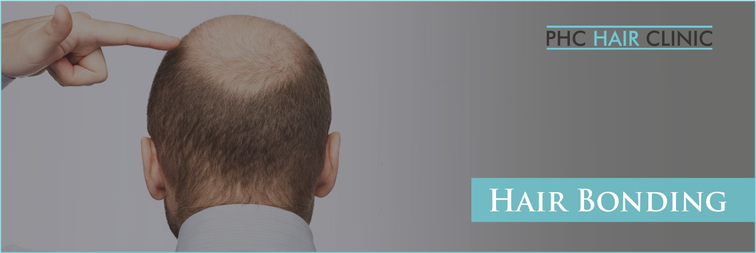 Hair Bonding in Delhi | ☝ Permanent Hair Bonding Clinic in New Delhi Hair Bonding in Delhi | ☝ Permanent Hair Bonding Clinic in New Delhi