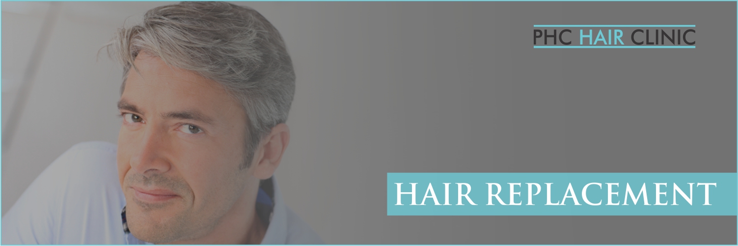 Hair Replacement in Faridabad