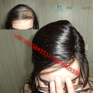 Hair Extensions in Delhi, Extension Services, Cost Review in Delhi NCR