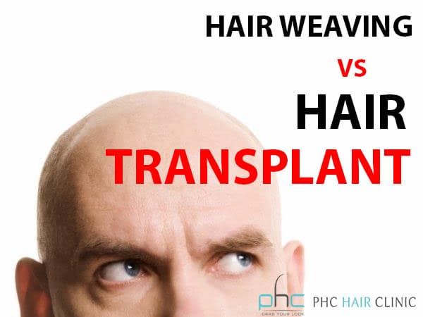 hair weaving vs hair transplant