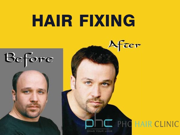 hair fixing