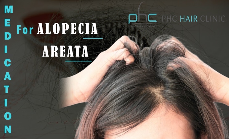 alopecia areata treatment
