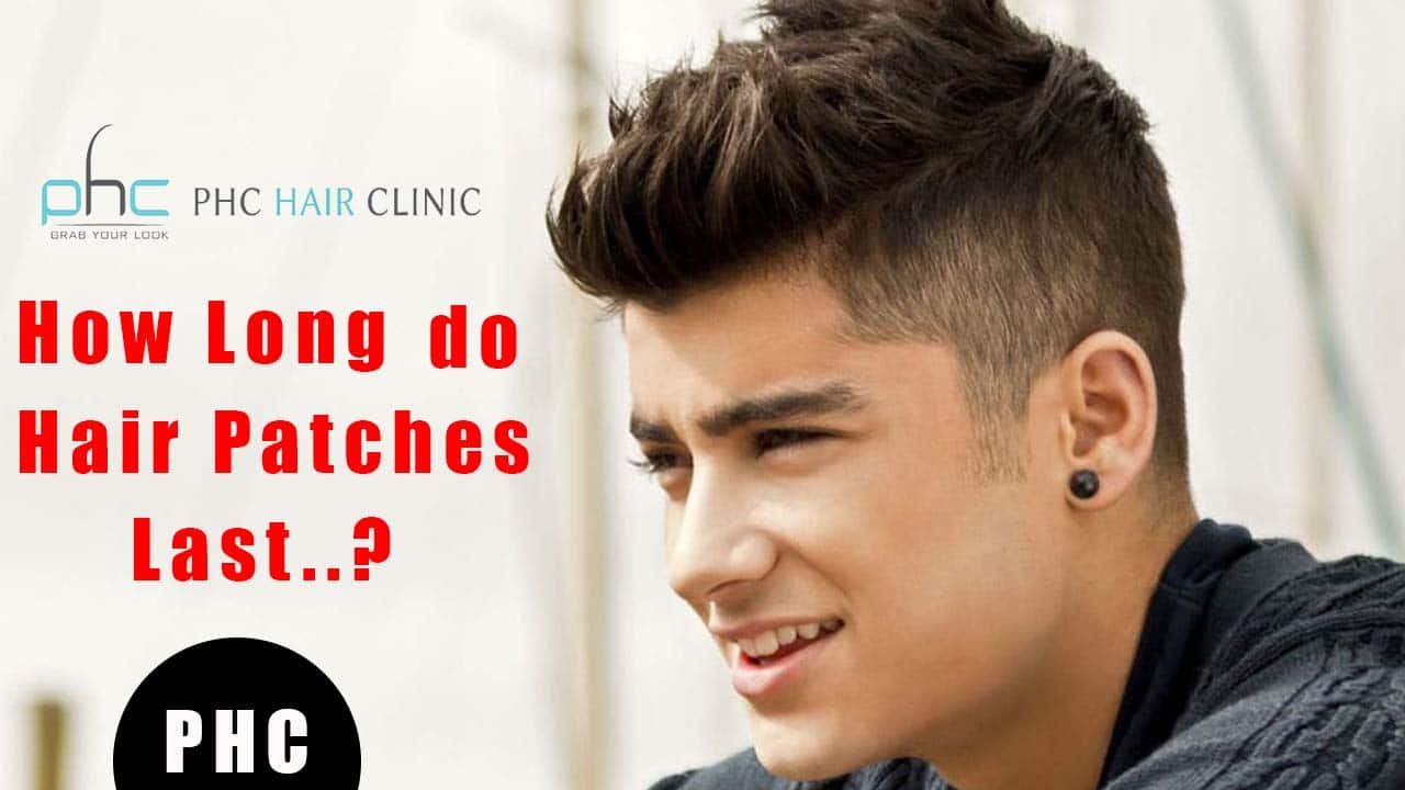 Hair Patches Life: How Long do hair patches last? | Procedure & Span