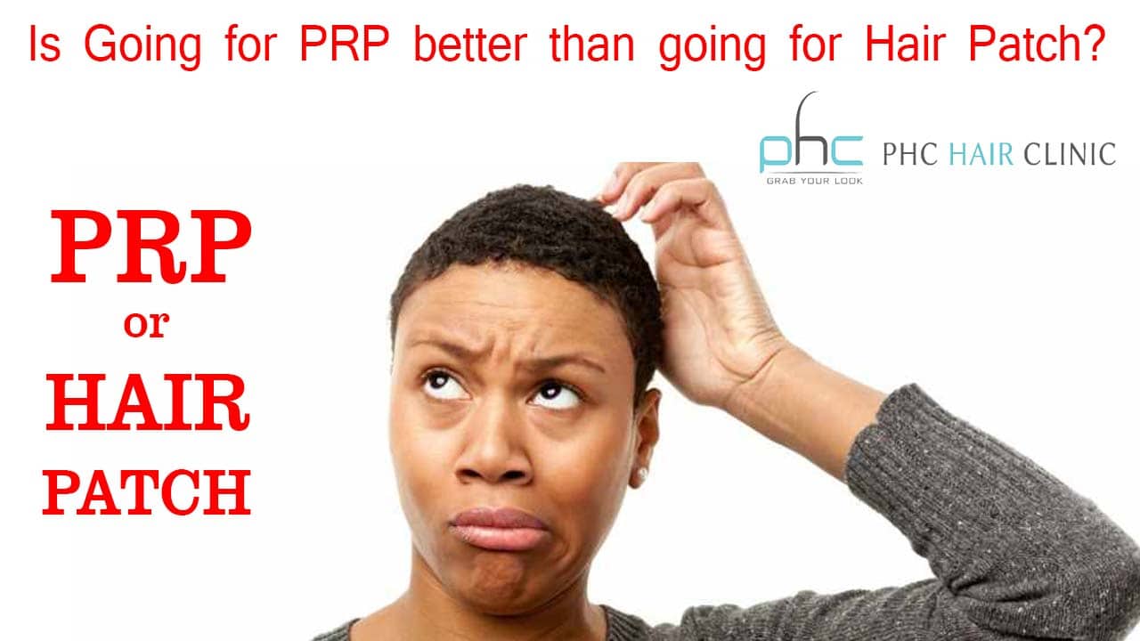 prp or hair patch system