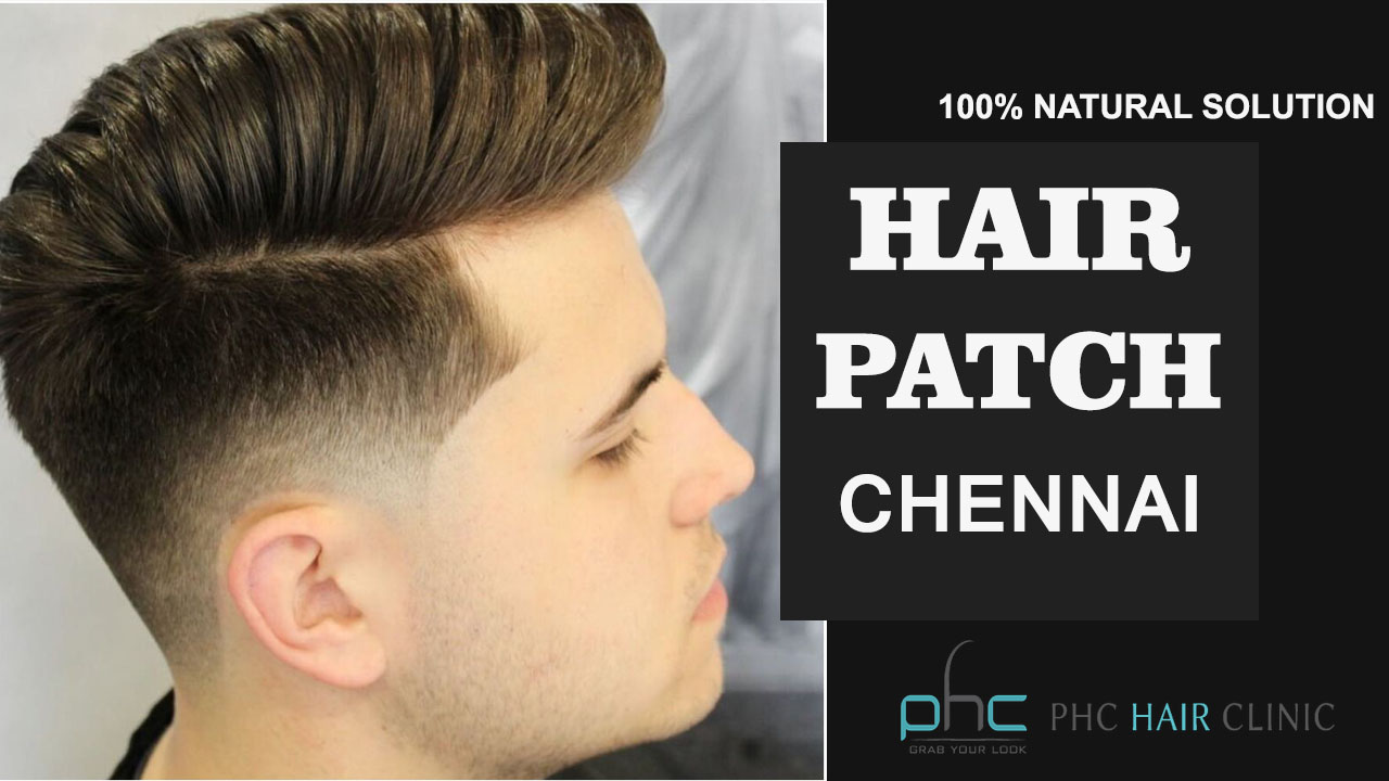 Hair Patch In Chennai : 7 Facts You Must Know About Hair Patch Chennai